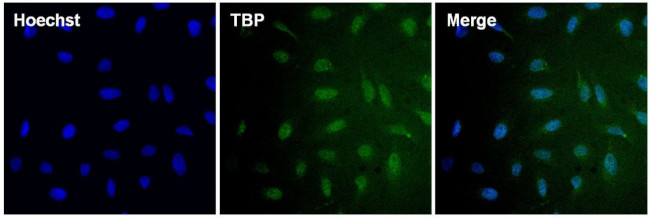 TBP Antibody in Immunocytochemistry (ICC/IF)