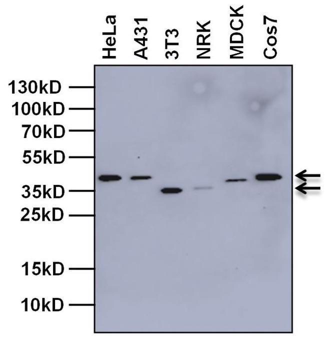 TBP Antibody in Western Blot (WB)