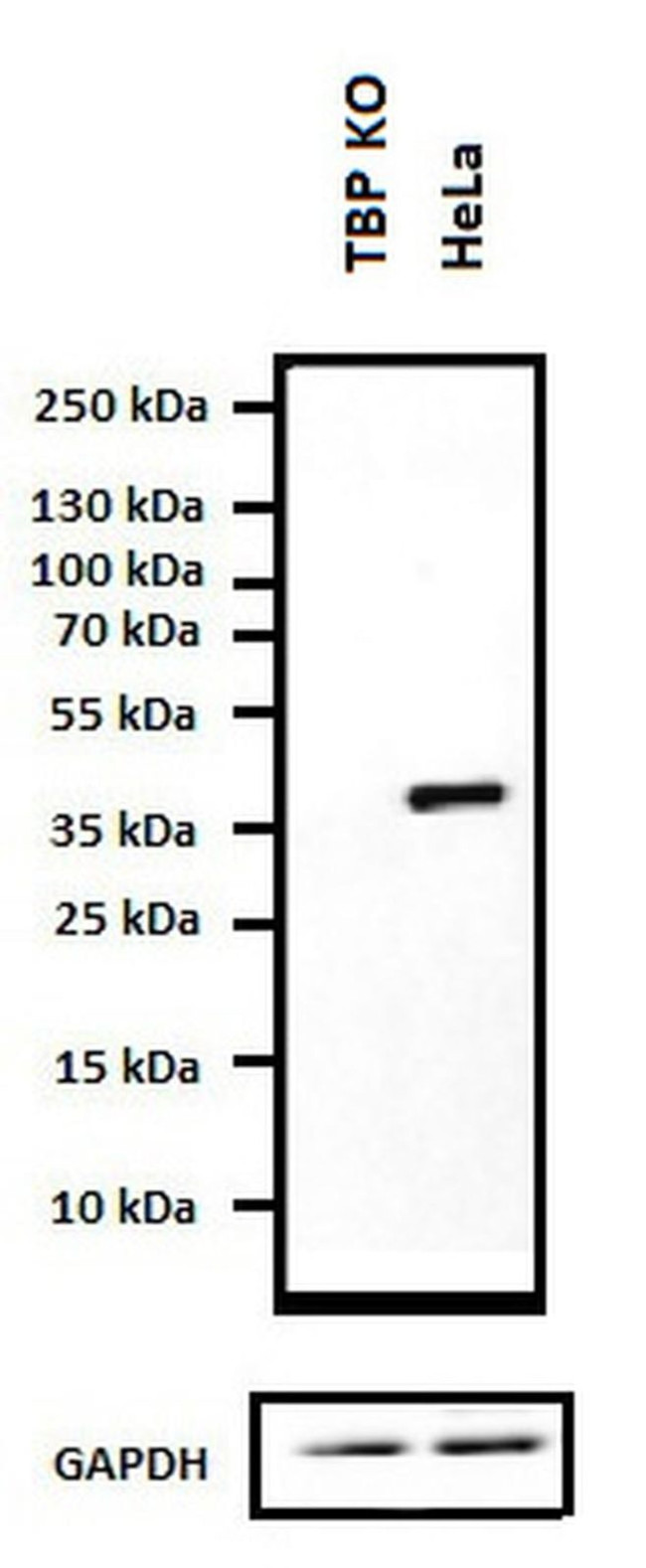 TBP Antibody