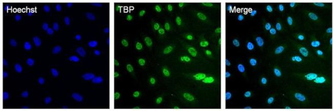 TBP Antibody in Immunocytochemistry (ICC/IF)