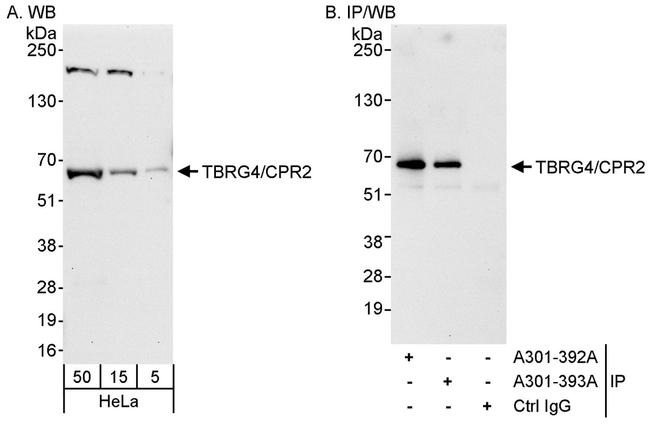 TBRG4/CPR2 Antibody in Western Blot (WB)