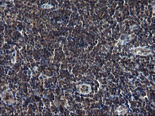 TBX1 Antibody in Immunohistochemistry (Paraffin) (IHC (P))