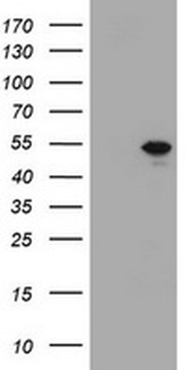 TBX19 (Tpit) Antibody in Western Blot (WB)