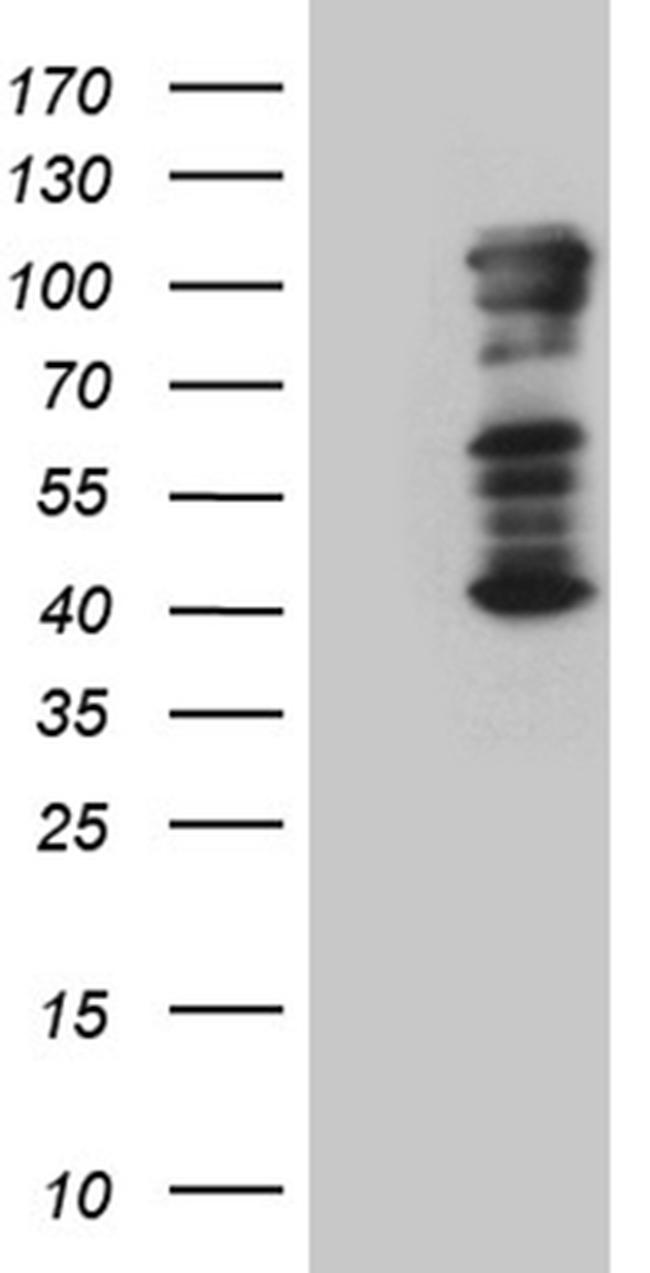 TBX3 Antibody in Western Blot (WB)