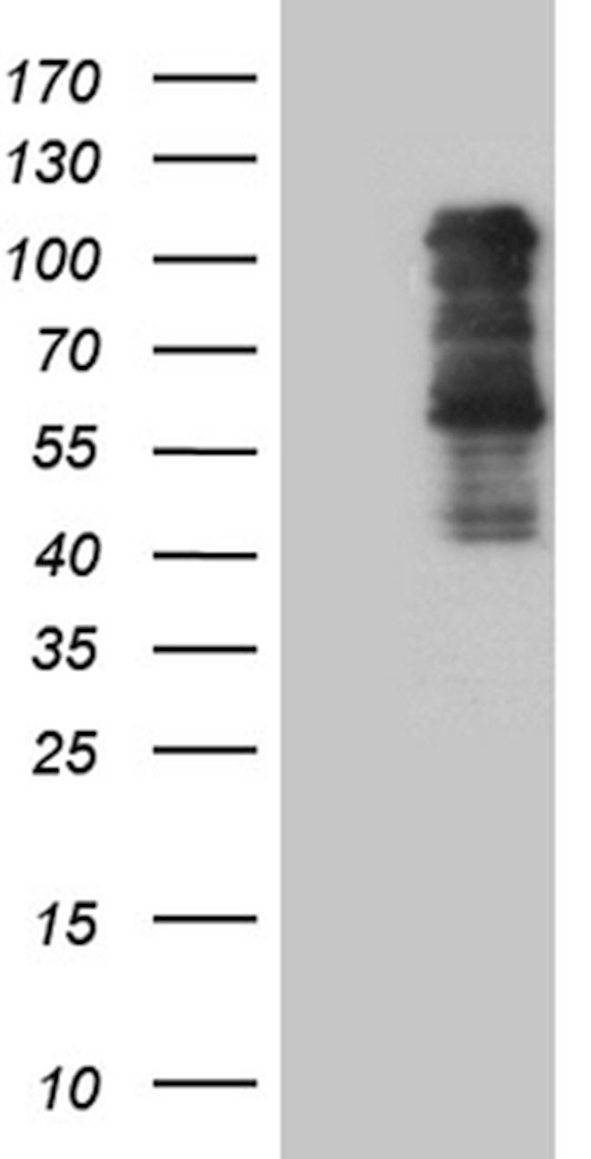 TBX3 Antibody in Western Blot (WB)