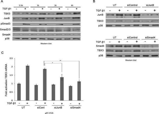 TBX3 Antibody in Western Blot (WB)