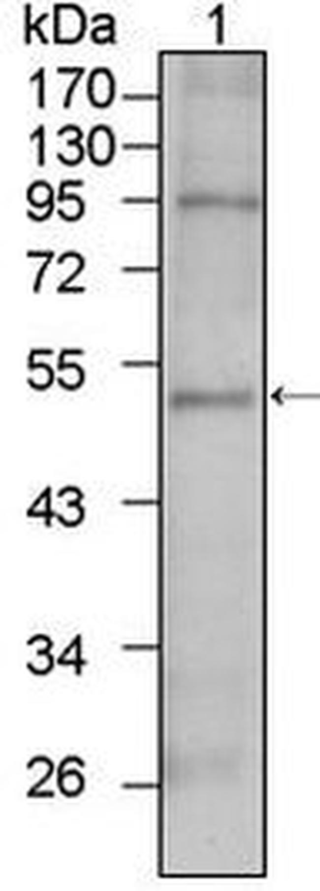 TBX5 Antibody in Western Blot (WB)