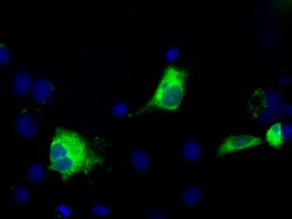 TBXAS Antibody in Immunocytochemistry (ICC/IF)