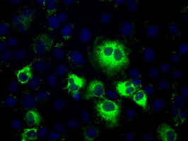 TBXAS Antibody in Immunocytochemistry (ICC/IF)