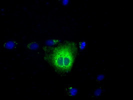 TBXAS Antibody in Immunocytochemistry (ICC/IF)