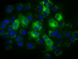 TBXAS Antibody in Immunocytochemistry (ICC/IF)