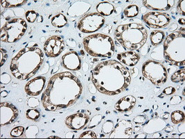 TBXAS Antibody in Immunohistochemistry (Paraffin) (IHC (P))