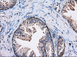 TBXAS Antibody in Immunohistochemistry (Paraffin) (IHC (P))