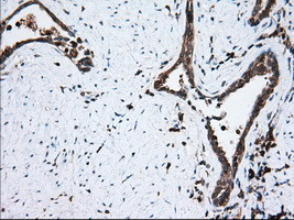 TBXAS Antibody in Immunohistochemistry (Paraffin) (IHC (P))