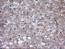 TBXAS Antibody in Immunohistochemistry (Paraffin) (IHC (P))