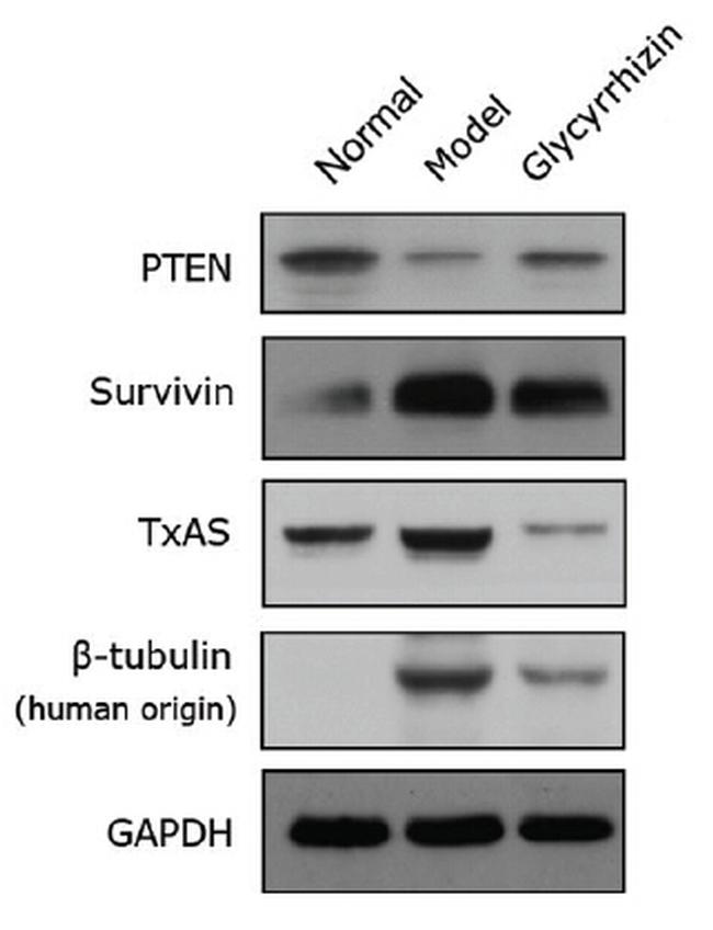 TBXAS Antibody in Western Blot (WB)