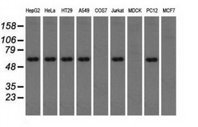 TBXAS Antibody in Western Blot (WB)