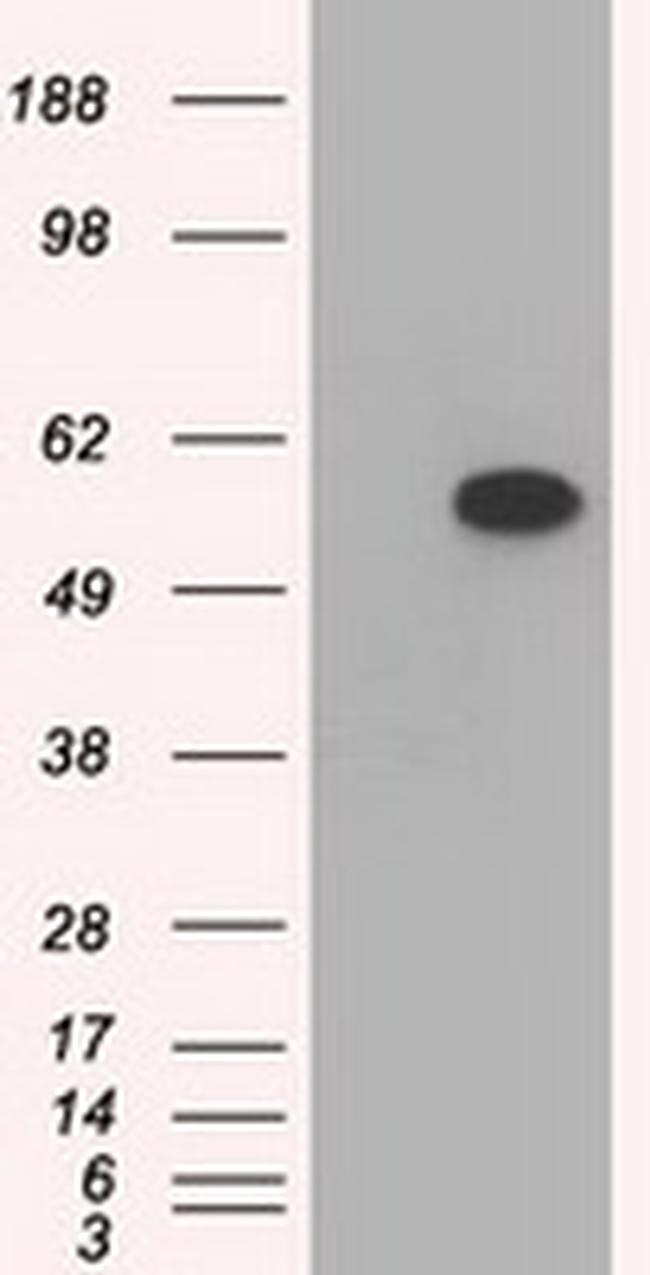 TBXAS Antibody in Western Blot (WB)