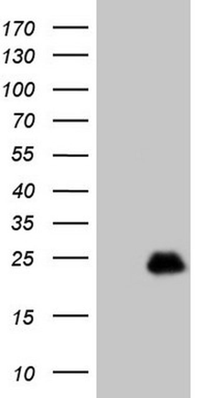 TCAP Antibody in Western Blot (WB)