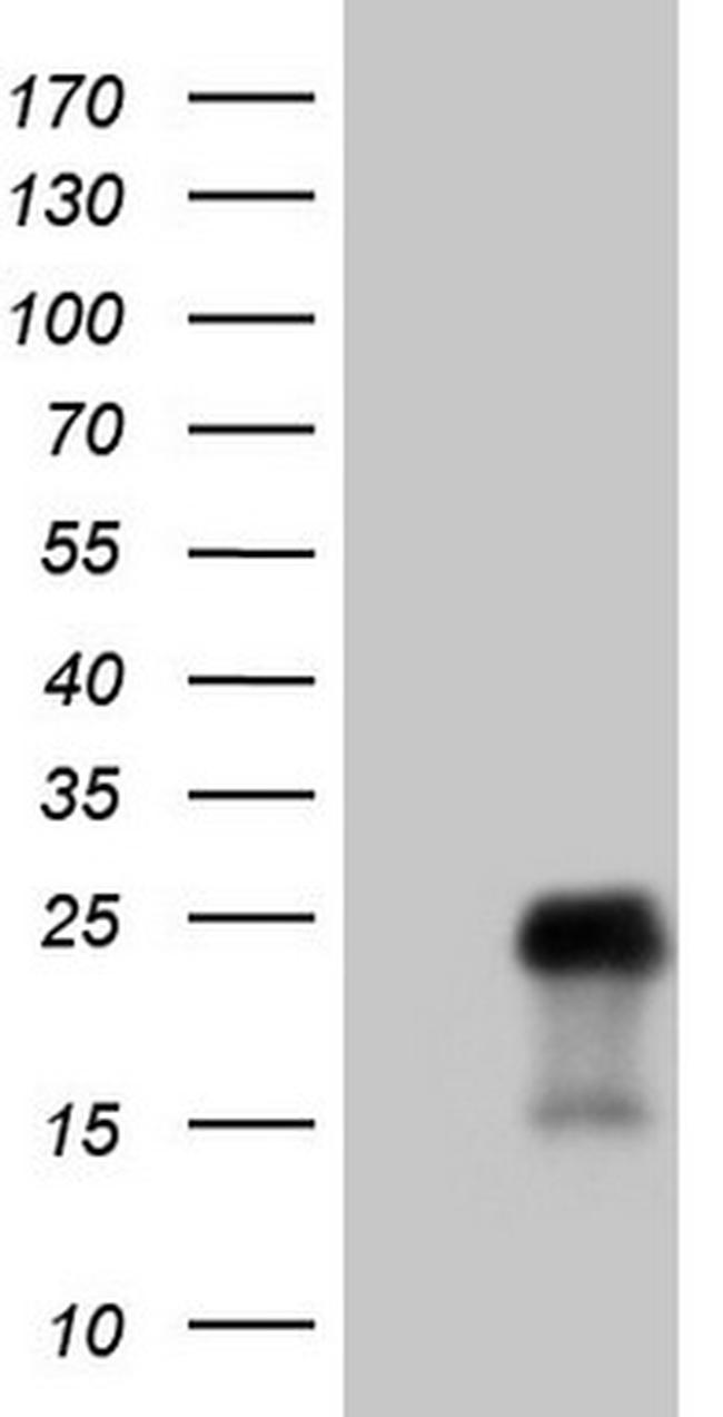 TCAP Antibody in Western Blot (WB)