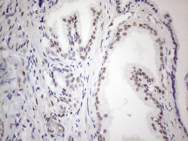 TCEAL1 Antibody in Immunohistochemistry (Paraffin) (IHC (P))