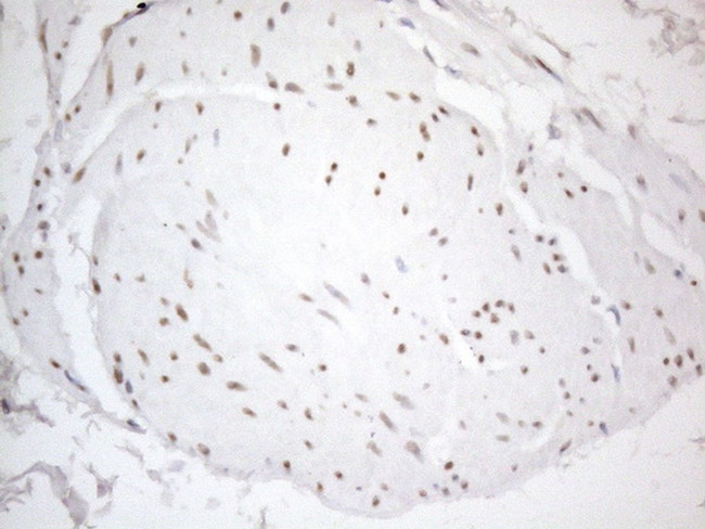 TCEAL1 Antibody in Immunohistochemistry (Paraffin) (IHC (P))