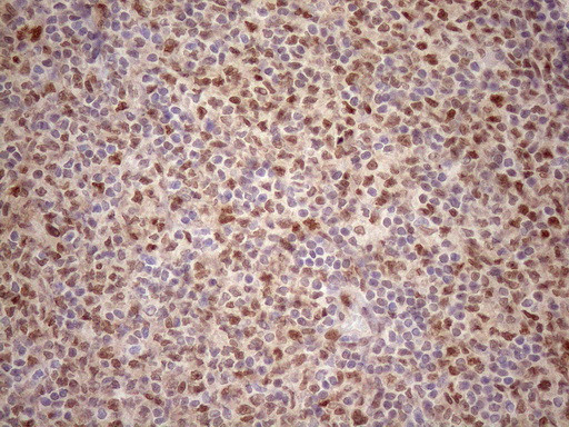 TCEAL1 Antibody in Immunohistochemistry (Paraffin) (IHC (P))