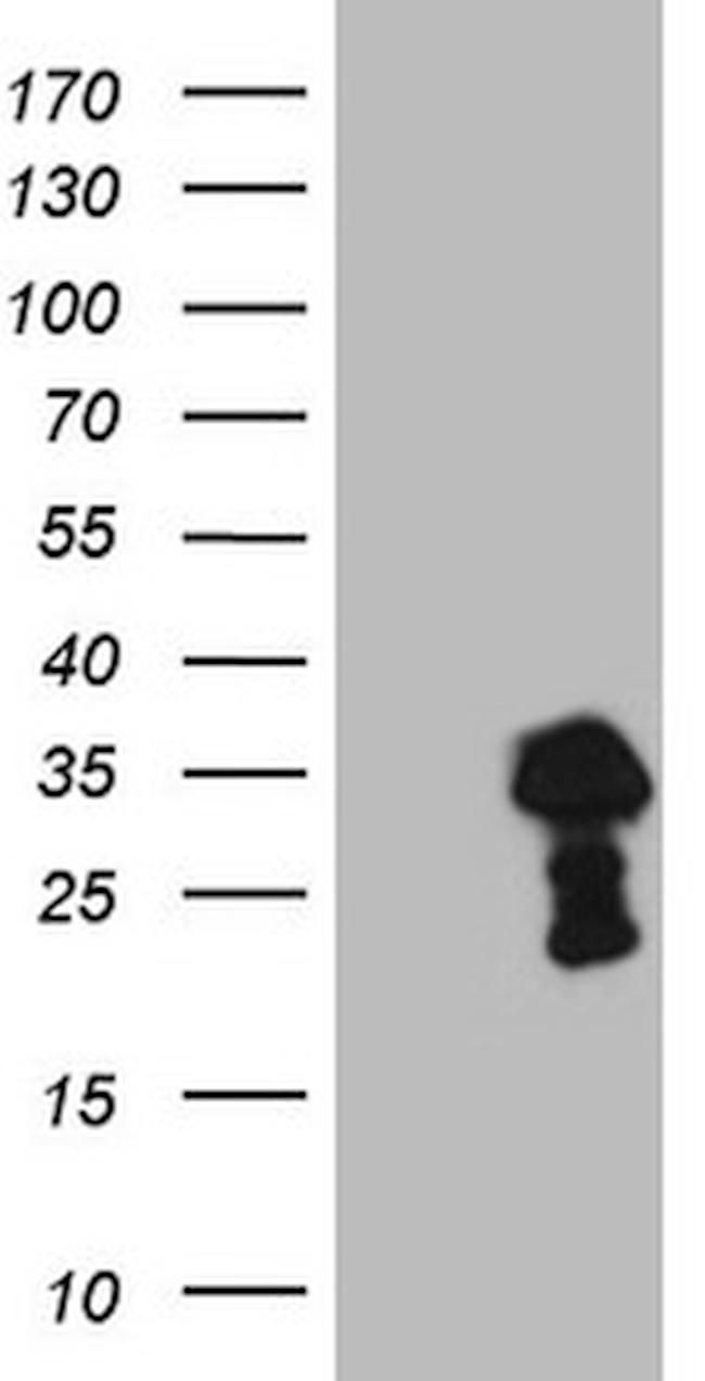 TCEAL1 Antibody in Western Blot (WB)