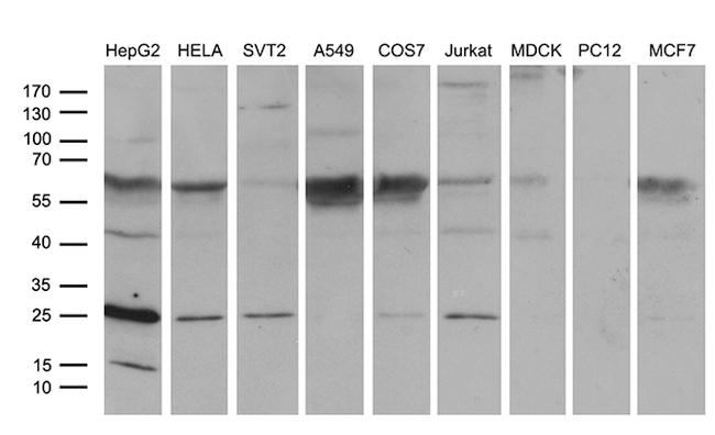 TCEANC2 Antibody in Western Blot (WB)