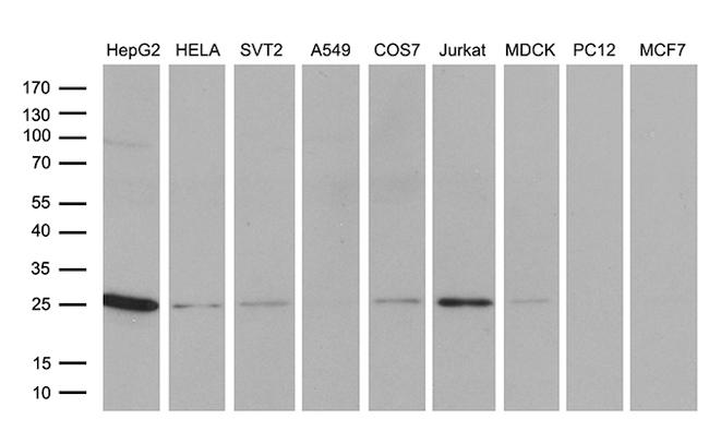 TCEANC2 Antibody in Western Blot (WB)