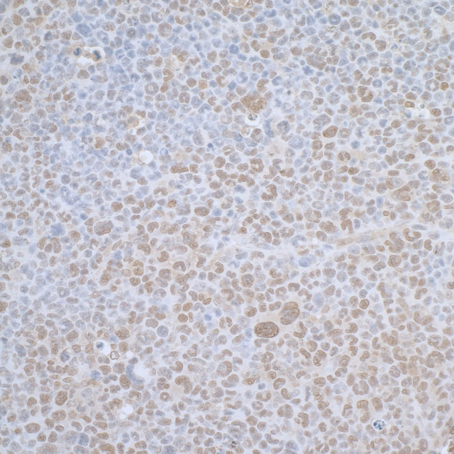 TCEB1 Antibody in Immunohistochemistry (IHC)