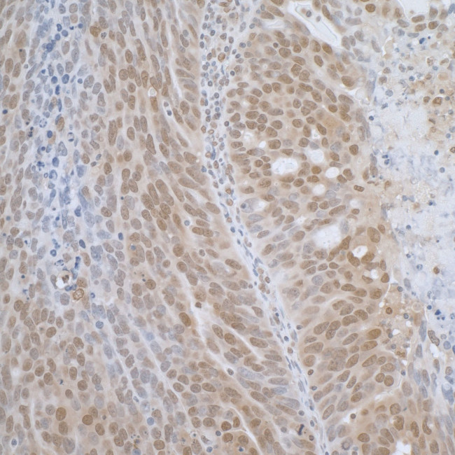 TCEB1 Antibody in Immunohistochemistry (IHC)