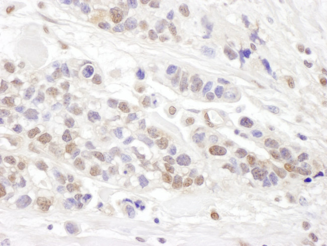 TCEB2 Antibody in Immunohistochemistry (IHC)