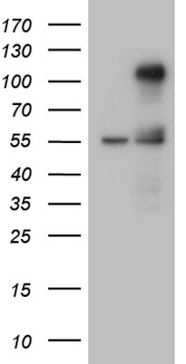 TCF12 Antibody in Western Blot (WB)