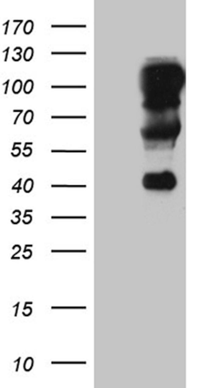 TCF12 Antibody in Western Blot (WB)