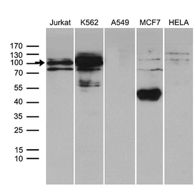 TCF12 Antibody in Western Blot (WB)