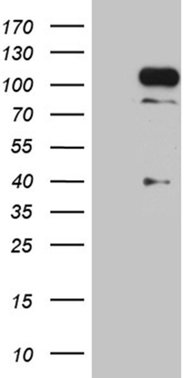 TCF12 Antibody in Western Blot (WB)