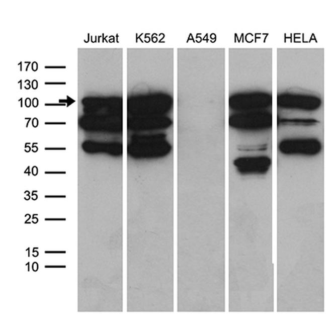 TCF12 Antibody in Western Blot (WB)