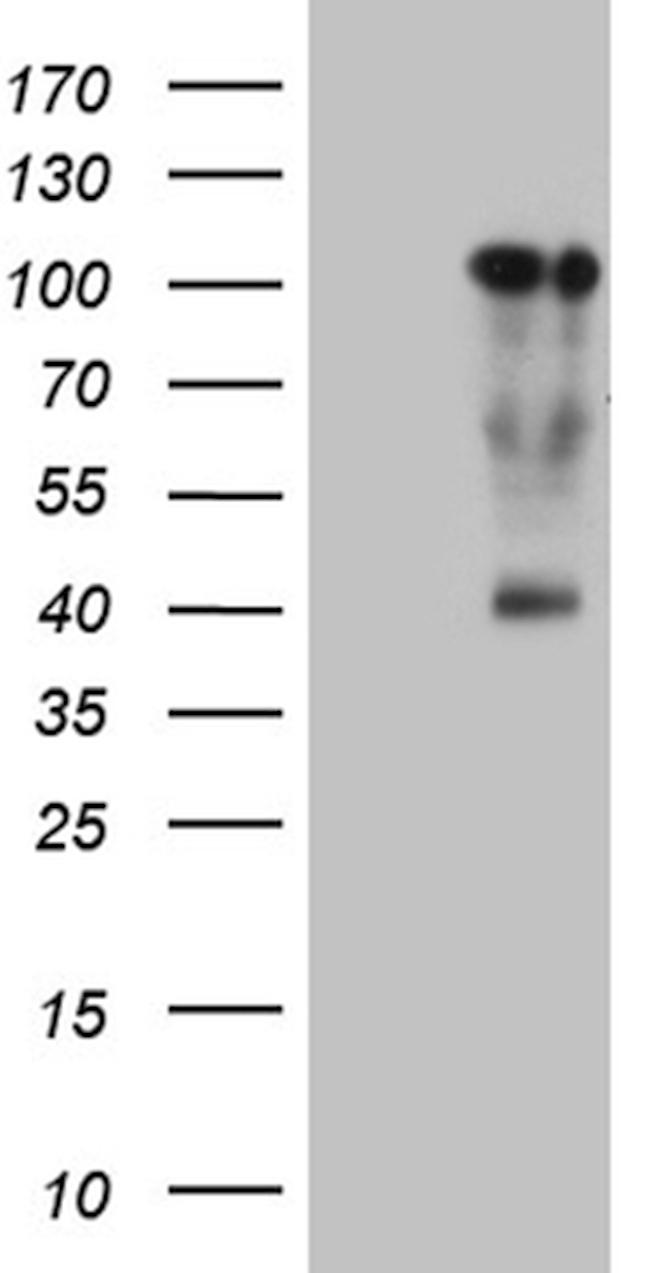 TCF12 Antibody in Western Blot (WB)