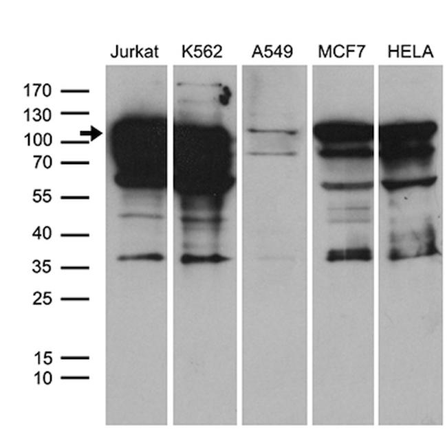 TCF12 Antibody in Western Blot (WB)