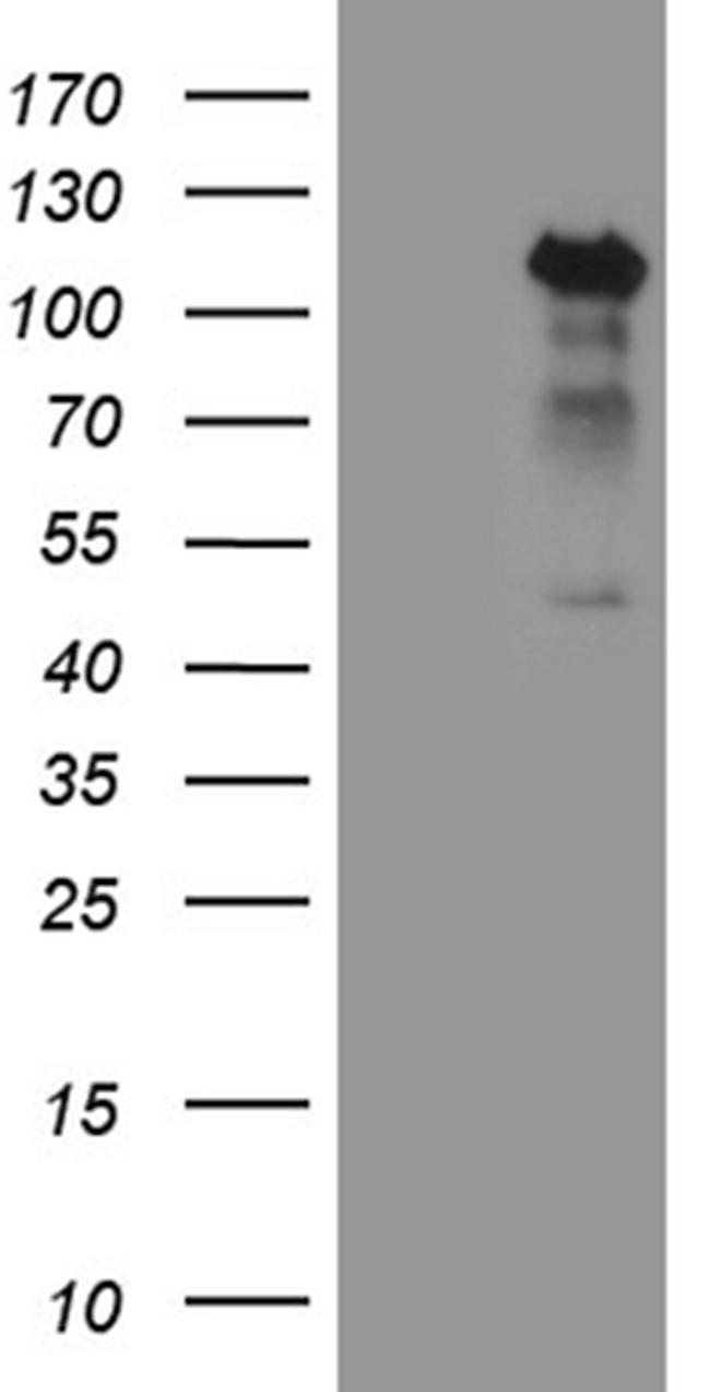 TCF12 Antibody in Western Blot (WB)