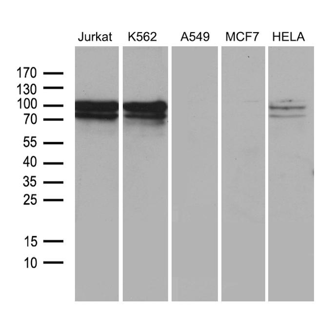 TCF12 Antibody in Western Blot (WB)