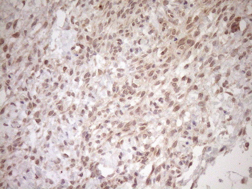 TCP10 Antibody in Immunohistochemistry (Paraffin) (IHC (P))