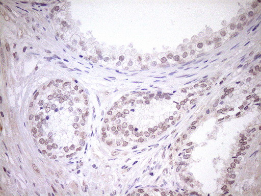 TCP10 Antibody in Immunohistochemistry (Paraffin) (IHC (P))