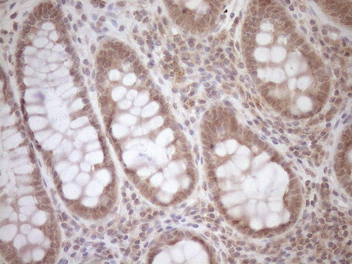 TCP10 Antibody in Immunohistochemistry (Paraffin) (IHC (P))