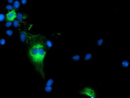 TCP11L2 Antibody in Immunocytochemistry (ICC/IF)