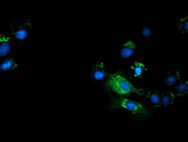 TCP11L2 Antibody in Immunocytochemistry (ICC/IF)