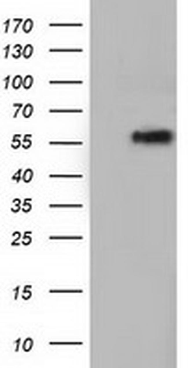 TCP11L2 Antibody in Western Blot (WB)