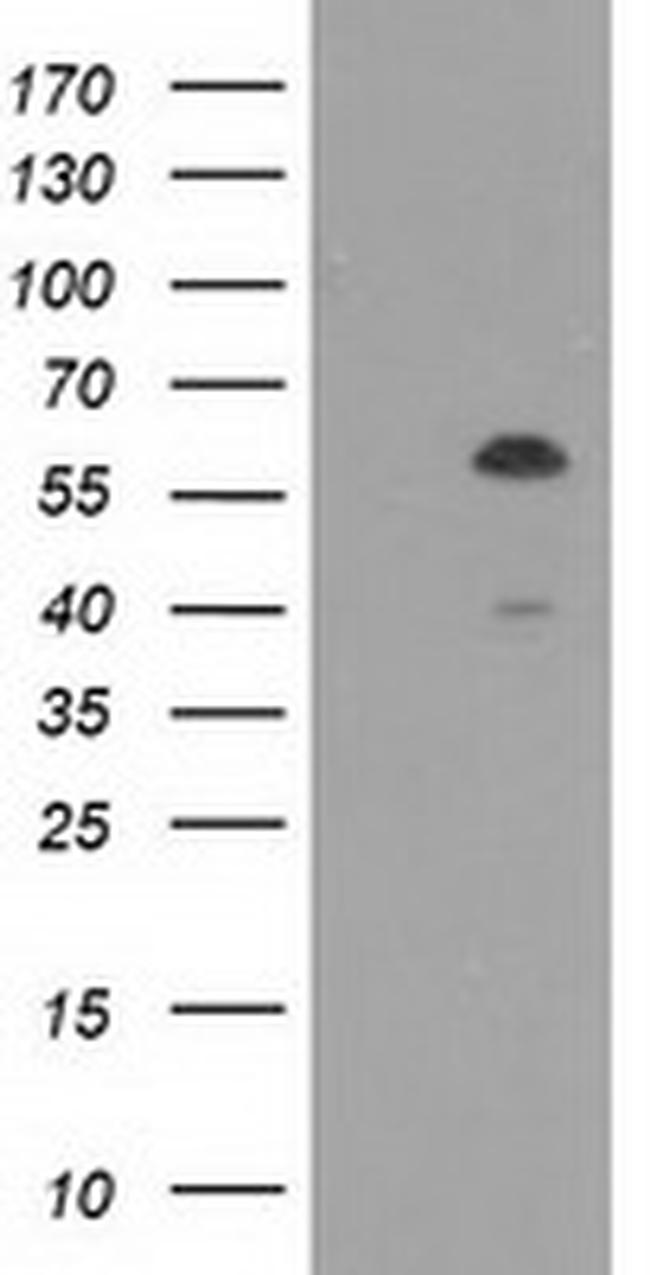 TCP11L2 Antibody in Western Blot (WB)