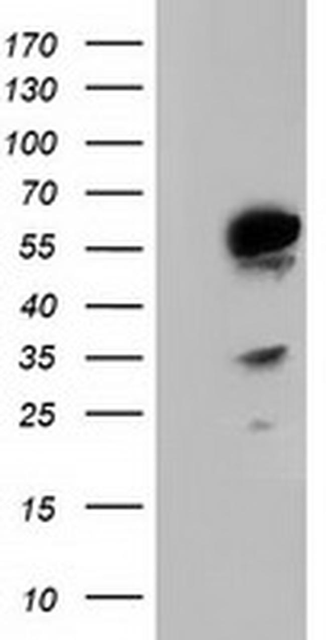 TCP11L2 Antibody in Western Blot (WB)